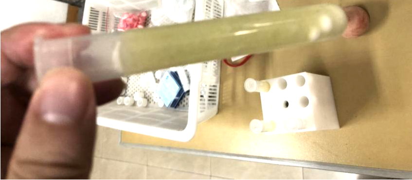 上海凈信-案列分享-葉綠素研磨